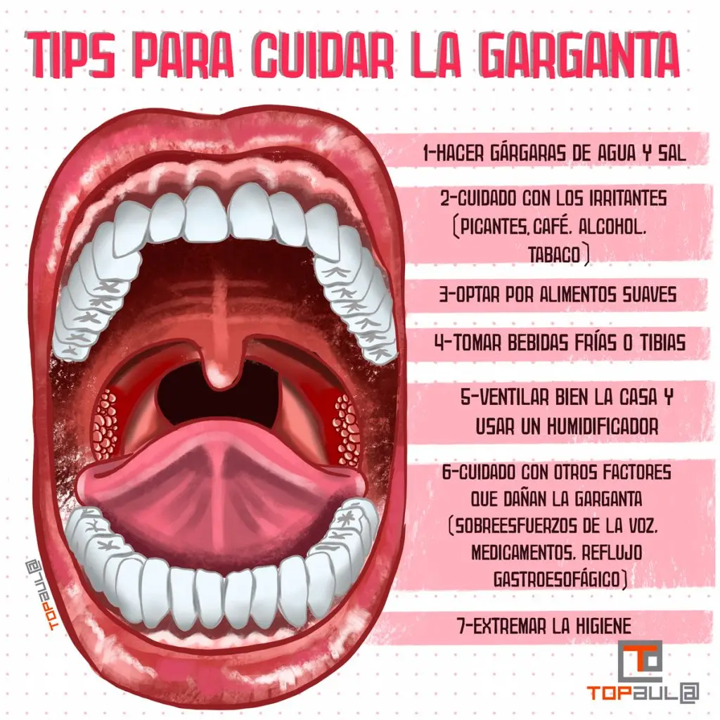 Infografía con consejos para cuidar la garganta